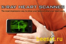 X-Ray Heart Scanner